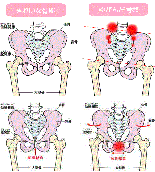 産後骨盤矯正,成田、よしなが治療院