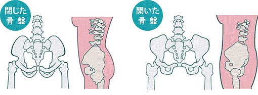 産後骨盤矯正,成田、よしなが治療院
